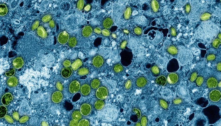 Neue Mpox-Variante Klade Ib erstmals in Deutschland nachgewiesen: RKI beruhigt, keine erhöhte Gefahr! Neue Mpox-Variante Klade Ib erstmals in Deutschland nachgewiesen: RKI beruhigt, keine erhöhte Gefahr!