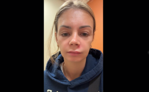 Pickel im „Todesdreieck“: TikTokerin landet nach Ausdrücken im Krankenhaus – Ärzte warnen vor Lebensgefahr