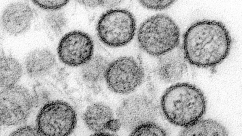 Tödlicher Ausbruch auf Kreuzfahrt: Hantavirus-Übertragung unter Menschen befürchtet
