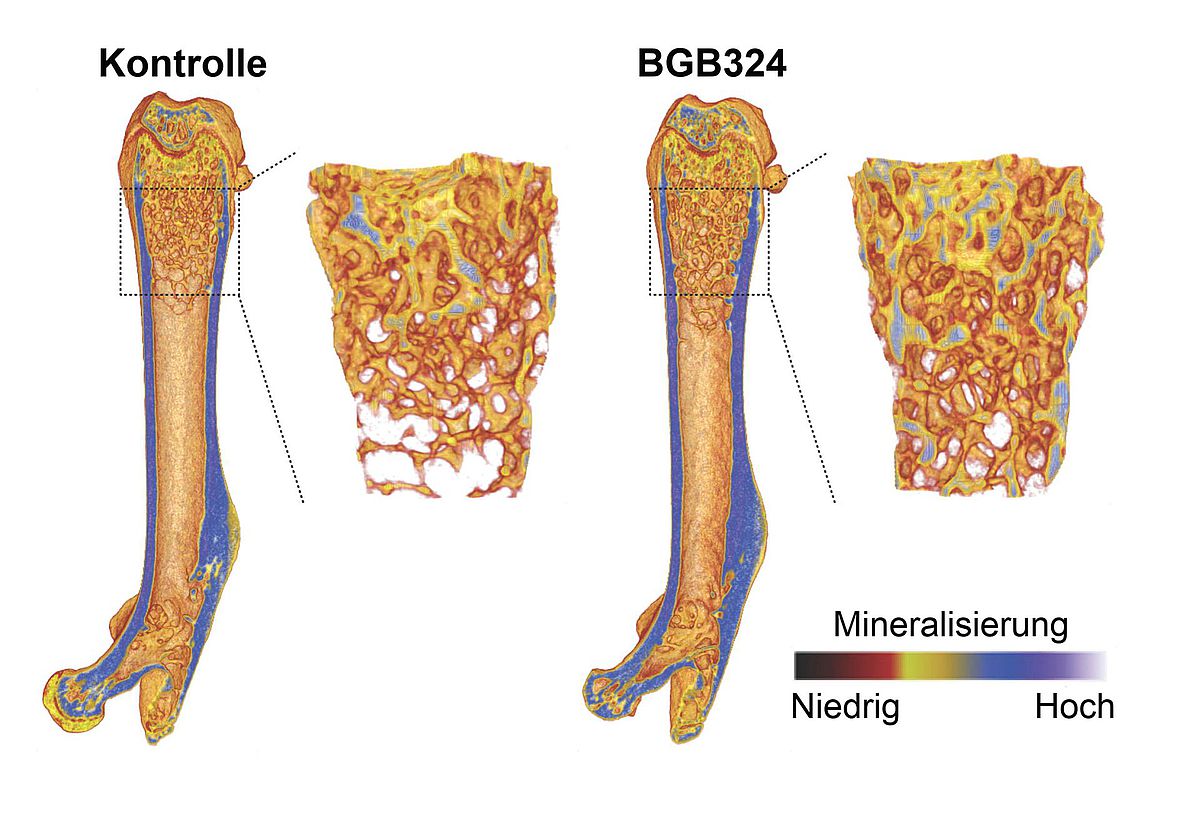 Mikro-CT-Aufnahmen von Mäuseknochen vergleichen eine Kontrollgruppe mit der BGB324-Behandlung