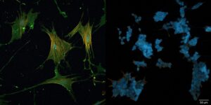 Mikroskopische Darstellung krebsassoziierter Fibroblasten mit und ohne CD44