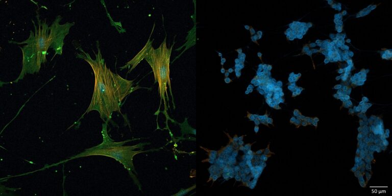 Mikroskopische Darstellung krebsassoziierter Fibroblasten mit und ohne CD44