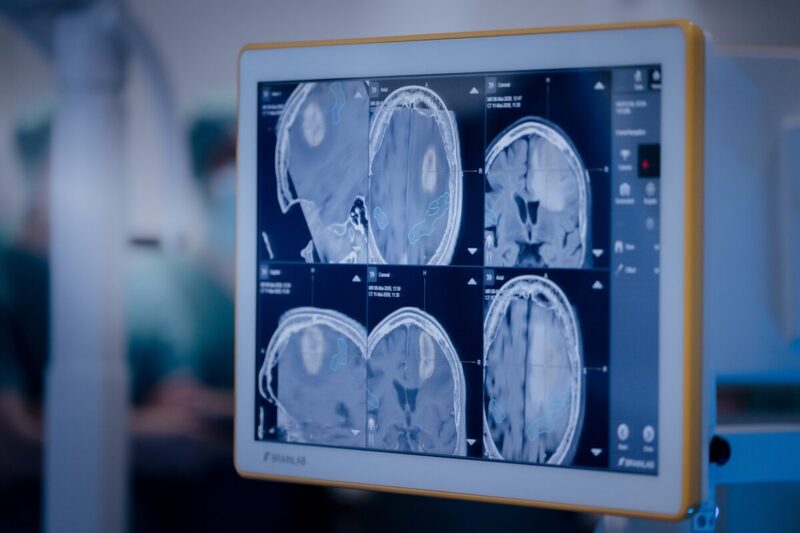 Medizinische Bildgebung während einer Strahlentherapie am KIT