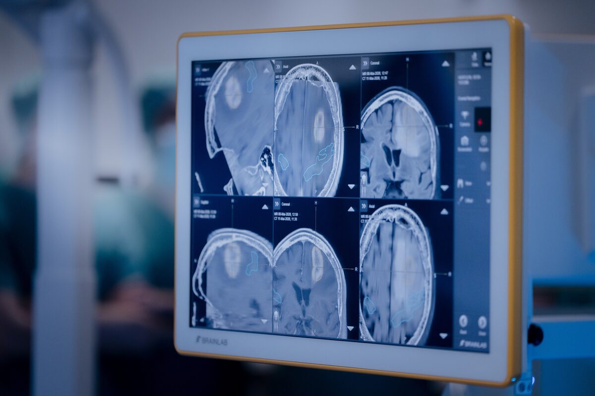 Medizinische Bildgebung während einer Strahlentherapie am KIT